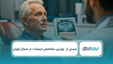 بهترین متخصص ایمپلنت در شمال تهران