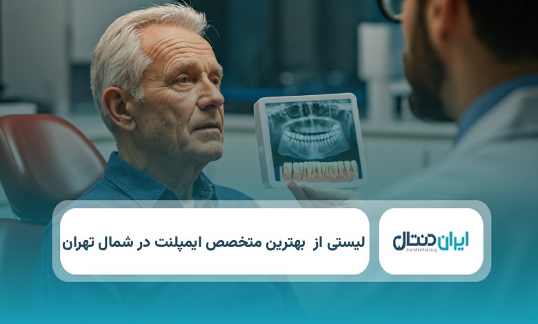 بهترین متخصص ایمپلنت در شمال تهران