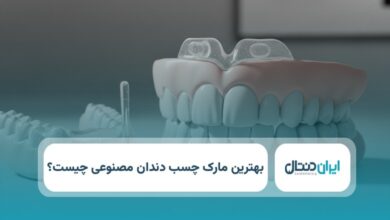 بهترین مارک چسب دندان مصنوعی چیست؟