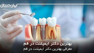 بهترین دکتر ایمپلنت در قم