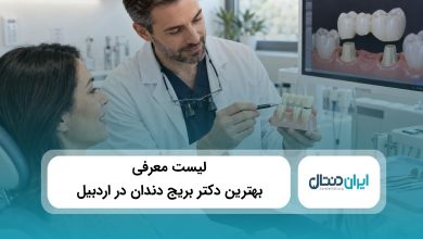 بهترین دکتر بریج دندان در اردبیل