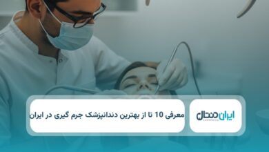 بهترین دندانپزشک جرم گیری در ایران