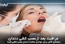 مراقبت بعد ازعصب کشی دندان؛راهنمای کامل برای دوام و سلامت دندان عصب کشی شده