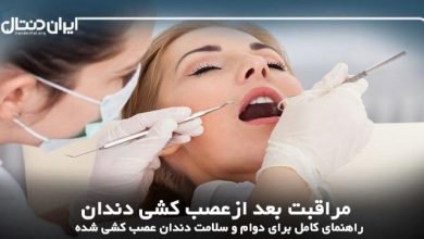 مراقبت بعد ازعصب کشی دندان؛راهنمای کامل برای دوام و سلامت دندان عصب کشی شده