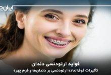 فواید ارتودنسی؛ تأثیرات فوق‌العاده ارتودنسی بر دندان‌ها و فرم چهره