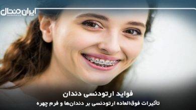 فواید ارتودنسی؛ تأثیرات فوق‌العاده ارتودنسی بر دندان‌ها و فرم چهره