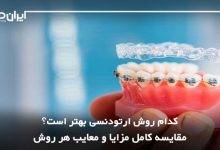 کدام روش ارتودنسی بهتر است؟