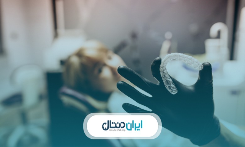 هزینه استفاده از کش ارتودنسی