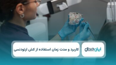 کش ارتودنسی: کاربرد، مزایا و مدت زمان استفاده از الاستیک ارتودنسی