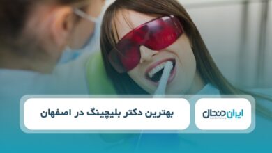بهترین دکتر بلیچینگ در اصفهان
