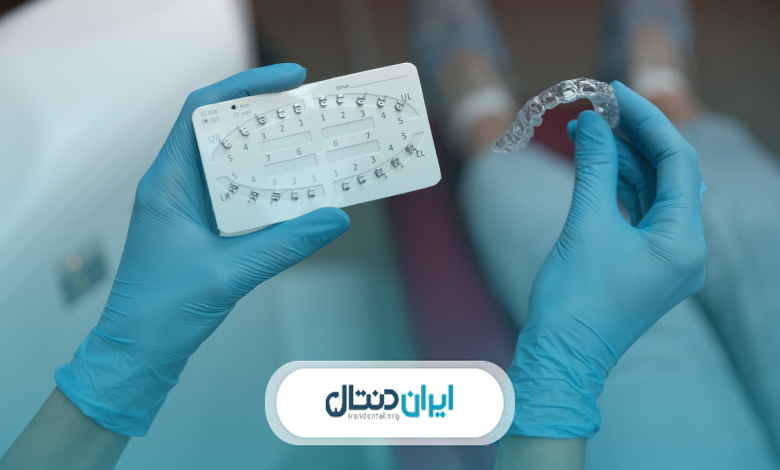 بهترین زمان انجام ارتودنسی از نظر بهترین متخصص های ارتودنسی