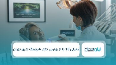 بهترین دکتر بلیچینگ در شرق تهران