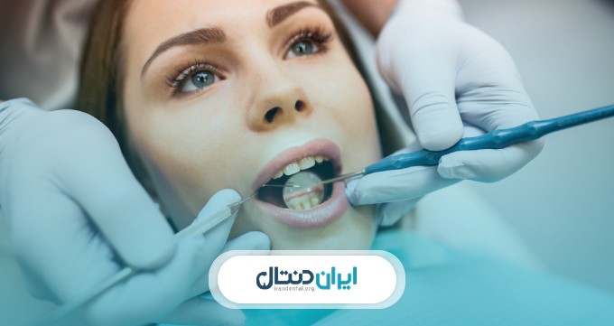 اقدامات لازم برای انجام کامپوزیت دندان