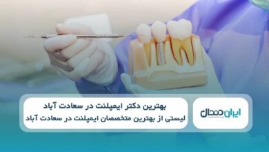 بهترین دکتر ایمپلنت در سعادت آباد
