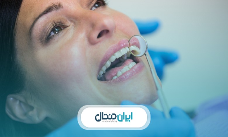 خدمات تخصصی بهترین متخصص لمینت در قیطریه