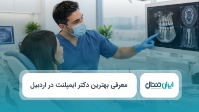 بهترین دکتر ایمپلنت در اردبیل