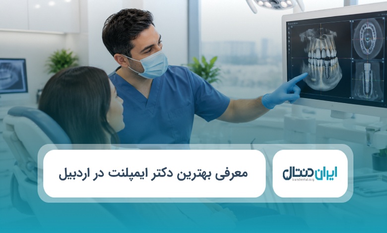 بهترین دکتر ایمپلنت در اردبیل