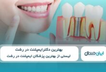 بهترین دکتر ایمپلنت در رشت