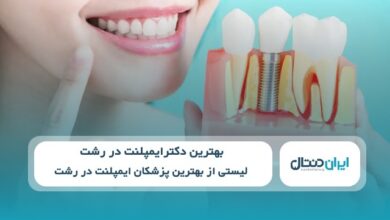 بهترین دکتر ایمپلنت در رشت