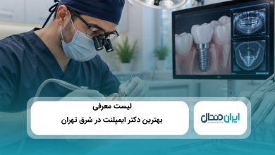 بهترین دکتر ایمپلنت در شرق تهران