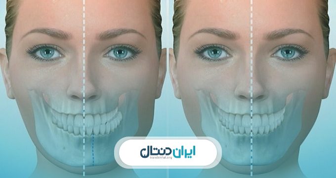 انواع بیماری های فک و صورت