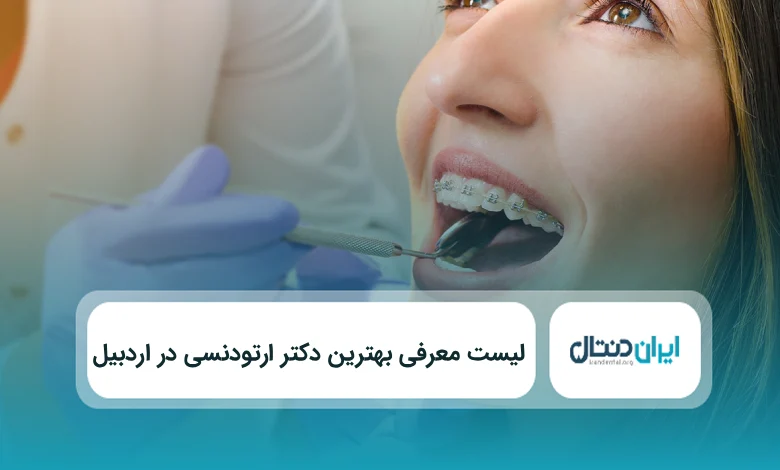 بهترین دکتر ارتودنسی در اردبیل