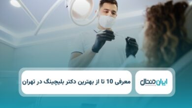بهترین دکتر بلیچینگ در تهران