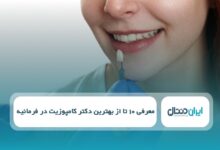 بهترین دکتر کامپوزیت در فرمانیه