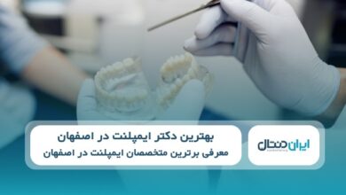 بهترین دکتر ایمپلنت در اصفهان