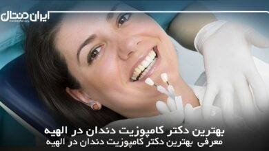 بهترین دکتر کامپوزیت دندان در الهیه