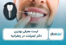 بهترین دکتر ایمپلنت در زعفرانیه
