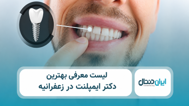 بهترین دکتر ایمپلنت در زعفرانیه