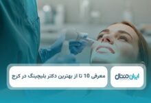بهترین دکتر بلیچینگ در کرج