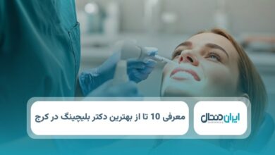بهترین دکتر بلیچینگ در کرج