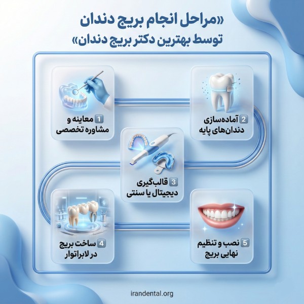ویژگیهای بهترین دکتر بریج دندان در تهران