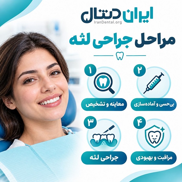 مراحل جراحی لثه