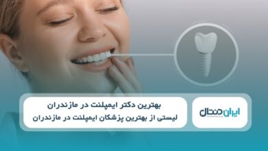 بهترین دکتر ایمپلنت در مازندران