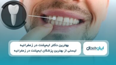 بهترین دکتر ایمپلنت در زغفرانیه
