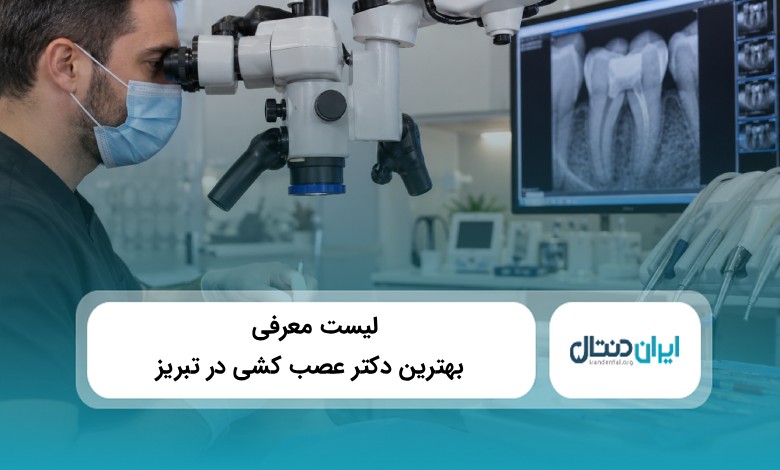 بهترین دکتر عصب کشی در تبریز