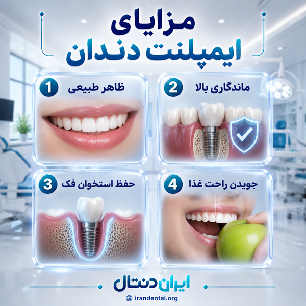 مزایای ایمپلنت دندان