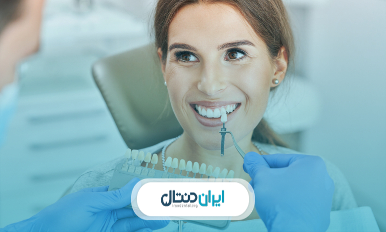 خدمات بهترین دکتر کامپوزیت دندان در الهیه
