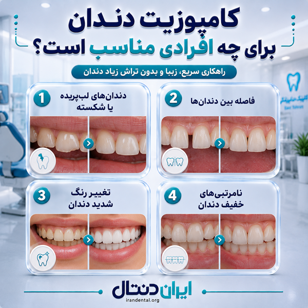 ویژگی های بهترین دکتر کامپوزیت دندان در الهیه