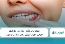 بهترین دکتر لثه در بوشهر