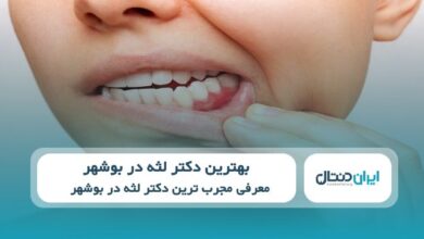 بهترین دکتر لثه در بوشهر