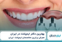 بهترین دکتر ایمپلنت در ایران