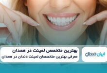 بهترین متخصص لمینت در همدان