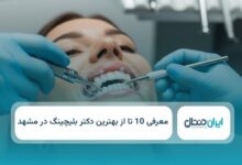 بهترین دکتر بلیچینگ در مشهد