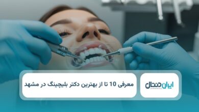 بهترین دکتر بلیچینگ در مشهد