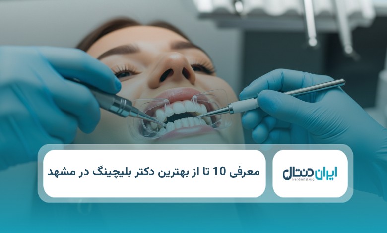 بهترین دکتر بلیچینگ در مشهد