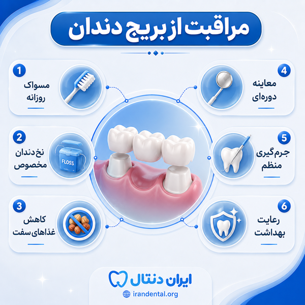 چه زمانی بریج دندان بهترین انتخاب برای شماست؟